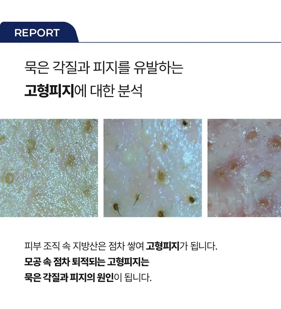 [피지클리너] 메디필 엑스트라 슈퍼 9 플러스 2.0 250ml 상세페이지 13